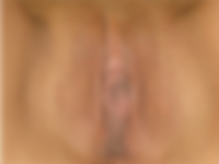 Cazul 4