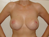 Case 4