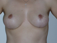 Case 5