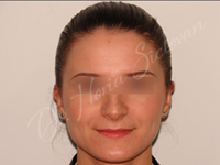 Case 3