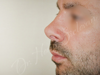 Case 10