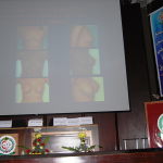 Speaker la Congresul de Chirurgie Plastica al Comunitatii Statelor Golfului, Riyadh, Arabia Saudita, aprilie 2008
